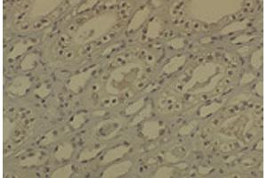 IHC analysis of DNMT1 in medullar kidney tissue sections using DNMT / DNMT1 antibody. (DNMT1 anticorps  (AA 637-650) (PerCP))