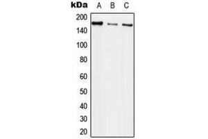 Western blot analysis of EGFR expression in MCF7 (A), Raw264. (EGFR anticorps  (Center))