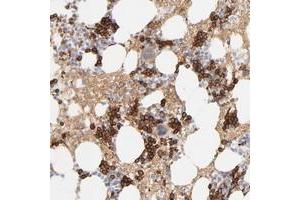 Immunohistochemical staining of human bone marrow with SPTB polyclonal antibody  shows strong cytoplasmic positivity in bone marrow poietic cells. (Spectrin beta Chain, Erythrocyte (SPTB) anticorps)