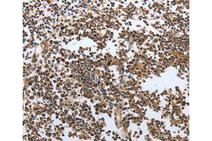 Immunohistochemistry (IHC) image for anti-MutS Homolog 6 (E. Coli) (MSH6) antibody (ABIN1873754) (MSH6 anticorps)