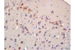 Formalin-fixed and paraffin embedded rat brain labeled with Rabbit Anti-mTOR (Ser2481) Polyclonal Antibody, Unconjugated 1:200 followed by conjugation to the secondary antibody and DAB staining