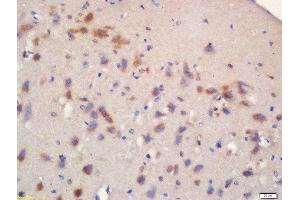 Formalin-fixed and paraffin embedded rat brain labeled with Rabbit Anti-mTOR (Ser2481) Polyclonal Antibody, Unconjugated 1:200 followed by conjugation to the secondary antibody and DAB staining (MTOR anticorps  (pSer2481))