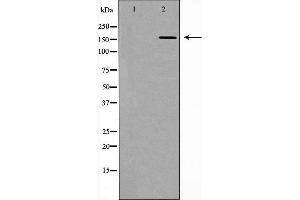 Western blot analysis of extracts of mouse lung, using DLC1 antibody. (DLC1 anticorps  (N-Term))