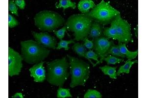 Immunofluorescence staining of A549 cells with ABIN7151958 at 1:100, counter-stained with DAPI. (Epsin 2 anticorps  (AA 15-300))