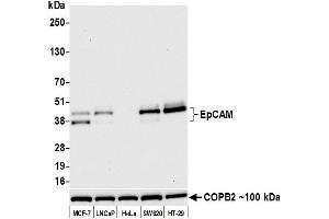 Western Blotting (WB) image for anti-Epithelial Cell Adhesion Molecule (EPCAM) (AA 24-265) antibody (ABIN7455170)