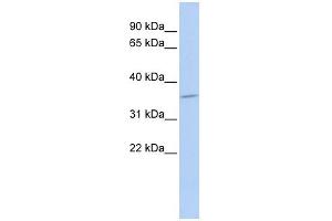 SULT1C4 antibody used at 1 ug/ml to detect target protein.