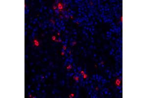 Immunofluorescence (IF) image for anti-Granzyme B (GZMB) (AA 19-247) antibody (ABIN7449554) (Recombinant GZMB anticorps  (AA 19-247))