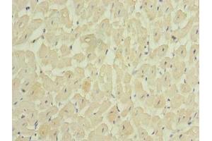 Immunohistochemistry of paraffin-embedded human heart tissue using ABIN7159179 at dilution of 1:100 (MEI1 anticorps  (AA 1-238))