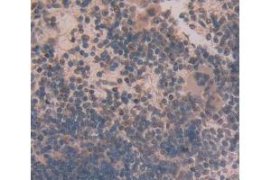 Used in DAB staining on fromalin fixed paraffin- embedded spleen tissue (Ninein anticorps  (AA 1-153))