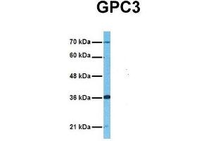 Host:  Rabbit  Target Name:  GPC3  Sample Tissue:  Human Adult Placenta  Antibody Dilution:  1. (Glypican 3 anticorps  (Middle Region))