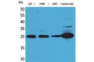 Western Blotting (WB) image for anti-Ubiquitin Carboxyl-terminal Esterase L1 (Ubiquitin Thiolesterase) (UCHL1) (Internal Region) antibody (ABIN6283260)