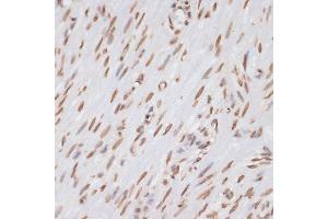 Immunohistochemistry of paraffin-embedded human appendix using Histone H3 antibody (ABIN3023242, ABIN3023243, ABIN3023244, ABIN1513010 and ABIN6219504) at dilution of 1:100 (40x lens). (Histone 3 anticorps  (C-Term))