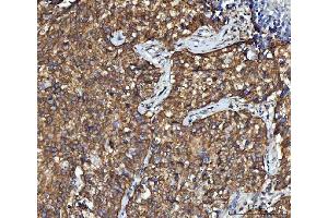 IHC analysis of CBR1 using anti-CBR1 antibody (ABIN7600015). (CBR1 anticorps  (AA 14-262))