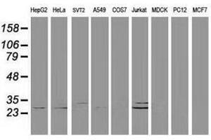 Image no. 8 for anti-Deoxycytidine Kinase (DCK) antibody (ABIN1497775)