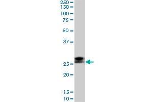 Western Blotting (WB) image for anti-Ring Finger Protein 141 (RNF141) (AA 141-230) antibody (ABIN599236) (RNF141 anticorps  (AA 141-230))