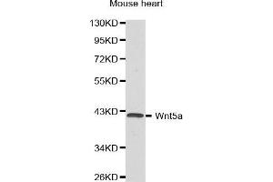 Western Blotting (WB) image for anti-Wingless-Type MMTV Integration Site Family, Member 5A (WNT5A) (AA 101-380) antibody (ABIN3023003) (WNT5A anticorps  (AA 101-380))