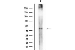 Western blot analysis of lysates from EC304 cells(heat-shock treatment), using TNF Receptor II Mouse Monoclonal Antibody.