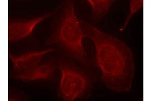 Immunofluorescence staining of methanol-fixed Hela cells using BIM(Phospho-Ser69) Antibody.