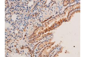 ABIN6267221 at 1/100 staining rat lung tissue sections by IHC-P.