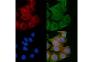 ABIN6259315 and ABIN6274430 staining Hela cells(45 min of heat-shock) by IF/ICC. (RGAG1 anticorps  (C-Term))