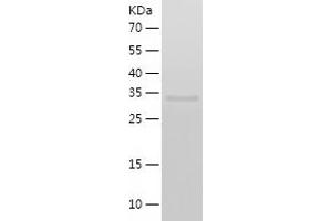 Western Blotting (WB) image for Signal Transducer and Activator of Transcription 5B (STAT5B) (AA 1-321) protein (His-IF2DI Tag) (ABIN7125095)