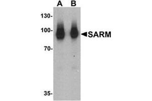 Western blot analysis of SARM in human kidney tissue lysate with SARM Antibody  at (A) 1 and (B) 2 ug/mL. (SARM1 anticorps  (N-Term))