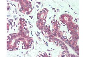 Anti-ITGA6 / CD49f antibody IHC of human breast. (ITGA6 anticorps  (N-Term))