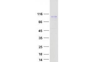 Validation with Western Blot