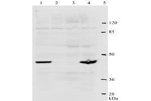Western-Blot analysis of HPV-18 E2 protein. (Human Papilloma Virus 18 E2 (HPV-18 E2) (AA 1-83) anticorps)