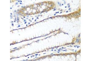 Immunohistochemistry of paraffin-embedded Human stomach using PPP4R1 Polyclonal Antibody at dilution of 1:100 (40x lens). (PPP4R1 anticorps)
