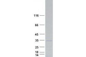 Validation with Western Blot