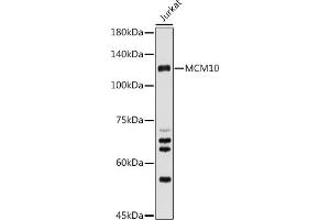 Western blot analysis of extracts of Jurkat cells, using MCM10 antibody (ABIN6129654, ABIN6143639, ABIN6143641 and ABIN6223024) at 1:500 dilution. (MCM10 anticorps  (AA 616-875))