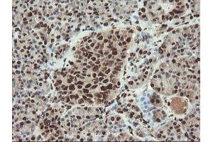 Image no. 5 for anti-SAM Domain and HD Domain 1 (SAMHD1) antibody (ABIN1500798)