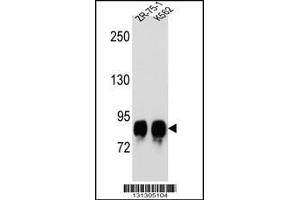 Western blot analysis in ZR-75-1,K562 cell line lysates (35ug/lane). (POMT1 anticorps  (C-Term))
