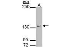 Image no. 2 for anti-Autism Susceptibility Candidate 2 (AUTS2) (AA 524-770) antibody (ABIN467523) (AUTS2 anticorps  (AA 524-770))