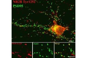 Immunostaining of 14 DIV rat cortical neurons showing NR2B phosphorylated at Tyr1252  in red and PSD95 in green.