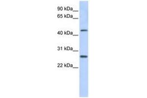 Image no. 1 for anti-PRAME Family Member 10 (PRAMEF10) (AA 396-445) antibody (ABIN6741262) (PRAMEF10 anticorps  (AA 396-445))