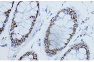 Immunohistochemistry of paraffin-embedded Human colon using LMNB1 Polyclonal Antibody at dilution of 1:200 (40x lens). (Lamin B1 anticorps)