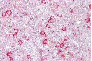 Immunohistochemistry with Tonsil tissue at an antibody concentration of 5µg/ml using anti-RHOD antibody (ARP42414_P050)