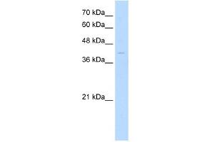 WB Suggested Anti-MKX Antibody Titration: 0. (MKX anticorps  (Middle Region))