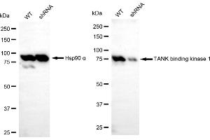 Western blotting analysis using TANK binding kinase 1 antibody (ABIN7800505).