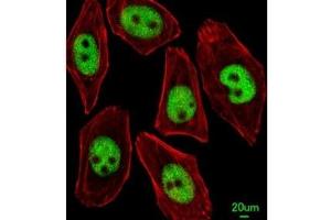 Immunofluorescent analysis of U251 cells using KLF4 antibody; Ab was diluted at 1:25 dilution.
