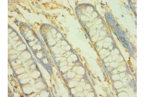 Immunohistochemistry of paraffin-embedded human colon tissue using ABIN7145745 at dilution of 1:100 (BCAT2 anticorps  (AA 20-200))