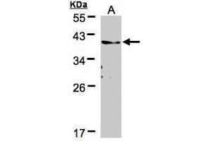 WB Image Sample(30 μg of whole cell lysate) A:A431, 12% SDS PAGE antibody diluted at 1:500 (TMEM59 anticorps)