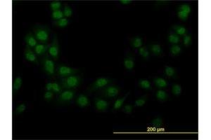 Immunofluorescence of monoclonal antibody to STK38 on HeLa cell.