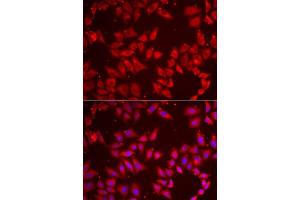 Immunofluorescence analysis of MCF7 cells using BAP1 antibody.