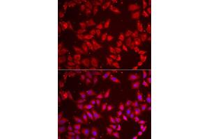 Immunofluorescence analysis of MCF7 cells using BAP1 antibody. (BAP1 anticorps  (AA 460-729))