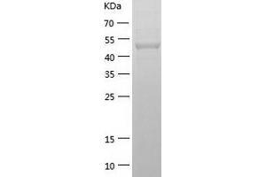 Western Blotting (WB) image for Glucosidase, Beta, Acid 3 (Cytosolic) (GBA3) (AA 1-469) protein (His tag) (ABIN7123109) (GBA3 Protein (AA 1-469) (His tag))