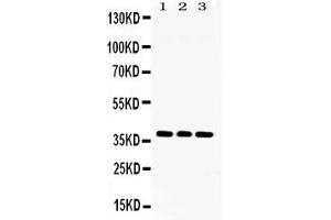 Western blot analysis of LDHB expression in rat brain extract ( Lane 1), NIH3T3 whole cell lysates ( Lane 2) and U2OS whole cell lysates ( Lane 3). (LDHB anticorps  (AA 237-334))