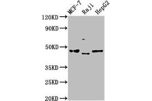 Western Blot Positive WB detected in: MCF-7 whole cell lysate, Raji whole cell lysate, HepG2 whole cell lysate All lanes: SERPINA11 antibody at 5 μg/mL Secondary Goat polyclonal to rabbit IgG at 1/50000 dilution Predicted band size: 47 kDa Observed band size: 47 kDa